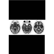 Neurological Case Histories