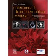Compendio de enfermedad tromboembólica venosa