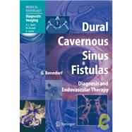 Dural Cavernous Sinus Fistulas