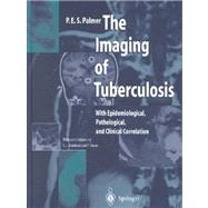 The Imaging of Tuberculosis: With Epidemiological, Pathological and Clinical Correlation