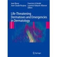 Life-threatening Dermatoses and Emergencies in Dermatology