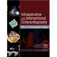 Intraoperative and Interventional Echocardiography