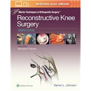 Master Techniques in Orthopaedic Surgery: Reconstructive Knee Surgery