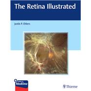 The Retina Illustrated