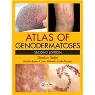 Atlas of Genodermatoses, Second Edition