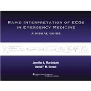 Rapid Interpretation of ECGs in Emergency Medicine A Visual Guide