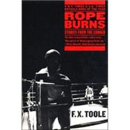 Rope Burns