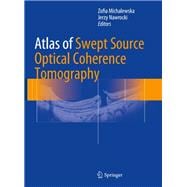 Atlas of Swept Source Optical Coherence Tomography