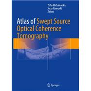 Atlas of Swept Source Optical Coherence Tomography