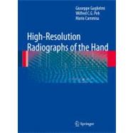 High-resolution Radiographs of the Hand