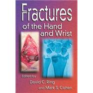 Fractures of the Hand And Wrist