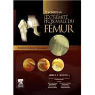 Fractures de l'extrémité proximale du fémur