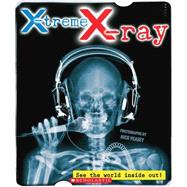 X-treme X-ray: See the World Inside Out! See The World Inside Out!