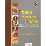 Phaco Without the Phaco