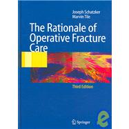 The Rationle Of Operative Fracture Care