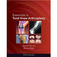 Essentials in Total Knee Arthroplasty