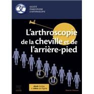 L'arthroscopie de la cheville et de l'arrière-pied