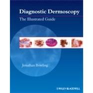 Diagnostic Dermoscopy The Illustrated Guide