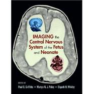Imaging the Central Nervous System of the Fetus And Neonate