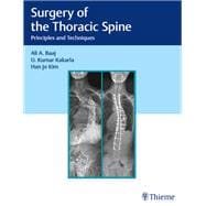 Surgery of the Thoracic Spine