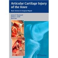 Articular Cartilage Injury of the Knee