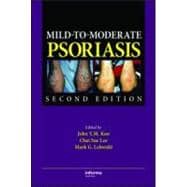 Mild-to-Moderate Psoriasis, Second Edition