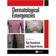 Dermatological Emergencies