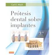 Prótesis dental sobre implantes