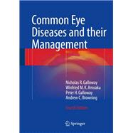 Common Eye Diseases and Their Management