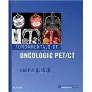 Fundamentals of Oncologic Pet/Ct