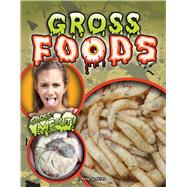 Gross Foods