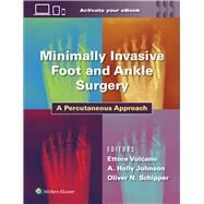 Minimally Invasive Foot and Ankle Surgery A Percutaneous Approach