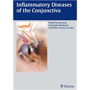 Inflammatory Diseases of the Conjuctiva,9783132578715