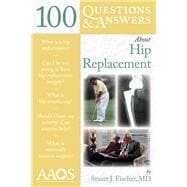 100 Questions  &  Answers About Hip Replacement