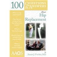 100 Questions & Answers About Hip Replacement