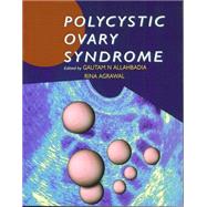 Polycystic Ovary Syndrome