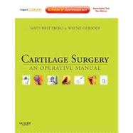 Cartilage Surgery