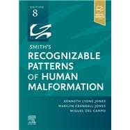Smith's Recognizable Patterns of Human Malformation - E-Book