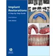Implant Restorations : A Step-by-Step Guide