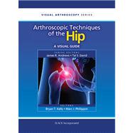 Arthroscopic Techniques of the Hip A Visual Guide