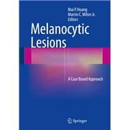 Melanocytic Lesions