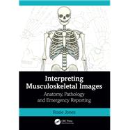 Interpreting Musculoskeletal Images