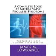 A Complete Look at Mitral Valve Prolapse Syndrome