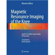 Magnetic Resonance Imaging of the Knee
