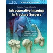 Illustrated Tips and Tricks for Intraoperative Imaging in Fracture Surgery