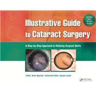 Illustrative Guide to Cataract Surgery