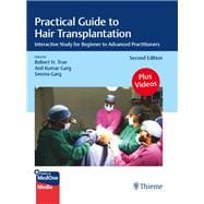 Practical Guide to Hair Transplantation,9788197299018