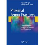 Proximal Femur Fractures