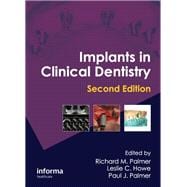 Implants in Clinical Dentistry, Second Edition
