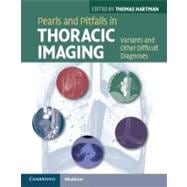 Pearls and Pitfalls in Thoracic Imaging: Variants and Other Difficult Diagnoses